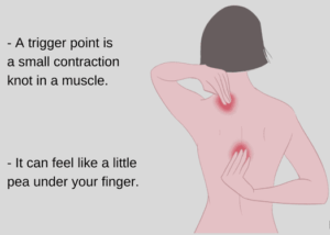 What Is A Trigger Point